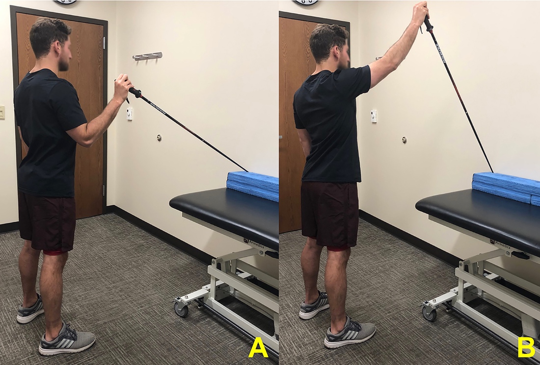 Isometric exercise during immobilization reduces the time to