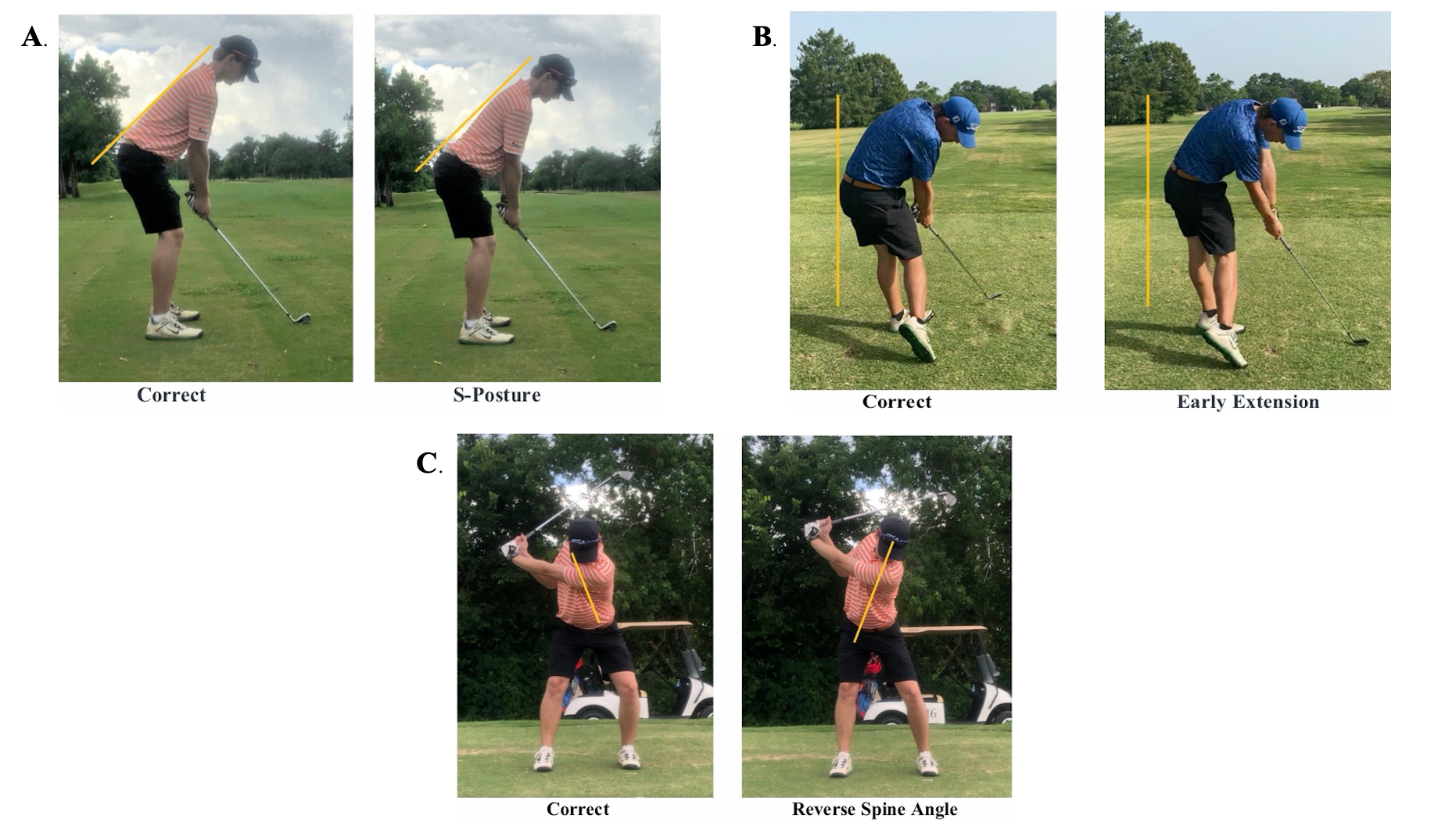 A Targeted Approach to Evaluating the Golfing Athlete with Low Back Pain: A  Resident's Case Report | Published in International Journal of Sports  Physical Therapy