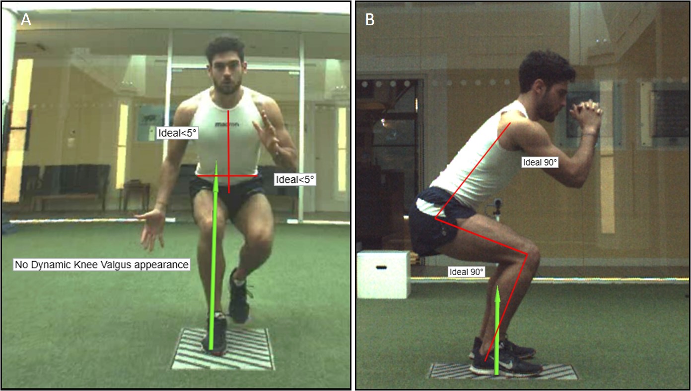 https://ijspt.scholasticahq.com/article/23549-recommendations-for-plyometric-training-after-acl-reconstruction-a-clinical-commentary/attachment/59306.jpg