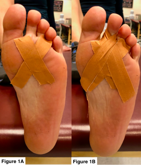 need help identifying whats up with my foot? : r/FootFunction