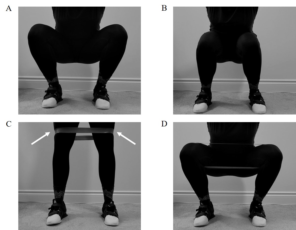 The Use of Elastic Resistance Bands to Reduce Dynamic Knee Valgus in  Squat-Based Movements: A Narrative Review